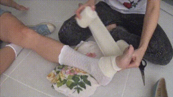My broken leg and masturbation with bandaging ff.webp