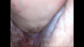 Wonderful endoscope for sperm inside the vagina.webp