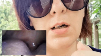 MiroCam new Vore exploration with medical PillCam in outdoor 720HD.webp