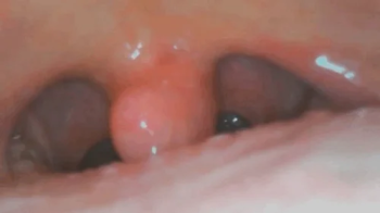 Two hours inside me - Digestion of Italian maccaroni pasta with meat Mpeg HD.webp