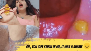 My tiny man got stuck in my pussy- Endoscopy.webp