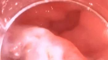 Eating Digesting Basmati Rice - Extreme Vore Exploration 1080AVI.webp