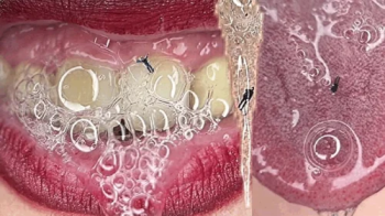 Custom- 7 tiny men in a waterfall of saliva in the mouth of a giantess.webp