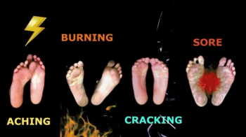 Life with Athlete's Foot IV - Parody on Desenex Family of Feet and more.webp