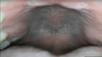 Public Hidden Vore Exploration - Inside Me at the Medical Center 720AVI.webp