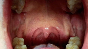 The Sounds of Digestion.webp