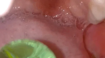 I swallow the marbles - Video re-edited in very high resolution 720HD.webp