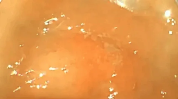 The doctor explores my belly full of meat to digest - FullScreen Exploration 720HD.webp