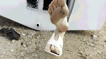 I lost my shoe while walking -16 MOV.webp