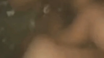 Ultra High Resolution Exploration with PillCam - 720HD.webp