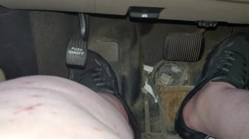 Pedal pushing toes out.webp