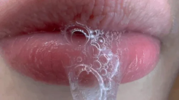 Tiny stuck on my uvula.webp
