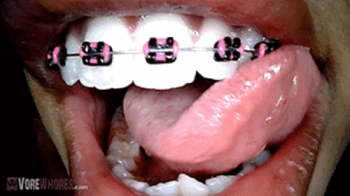 Naomi Braces Endoscopic Tour 720 HD POV Giantess Vore.webp
