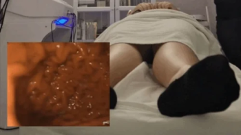 Public Exploration in the Center with the PillCam - Stomach Full of Sushi 720HD.webp
