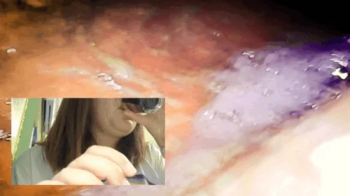 Eating a margherita pizza swallowing pillcam in public restaurant 720HD.webp