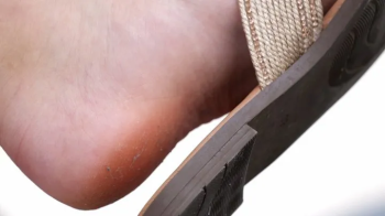 Candid dirty feet slippers dangling, foot fetish admiration, hot feet and shoes close-up.webp