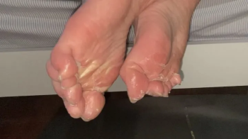 Bare toes stuck fast with superglue.webp