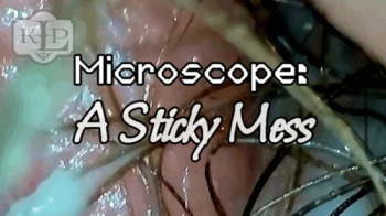 Microscope- A Sticky Mess.webp