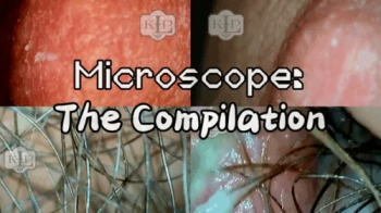Microscope- The Compilation.webp